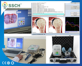 CE प्रमाण पत्र के साथ 8D LRIS एनएलएस पूर्ण शारीरिक स्वास्थ्य विश्लेषक स्वास्थ्य स्कैनर