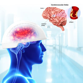 दर्दनाक मस्तिष्क चोट मस्तिष्क Photobiomodulation डिवाइस 810nm तरंग दैर्ध्य