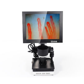पोर्टेबल 10 इंच एलईडी डिस्प्ले नेल फोल्ड कैपिलोस्कोपी माइक्रोकिरकुलेशन टेस्ट मशीन