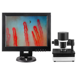 रक्त केशिका माइक्रोकिरियुलेशन माइक्रोस्कोप 600X आवर्धन DC12V 2A आउटपुट