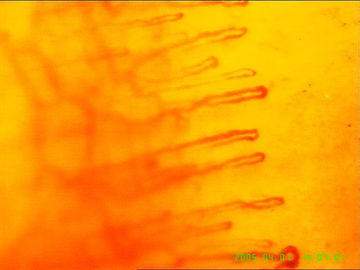 शरीर के स्वास्थ्य का पता लगाने के लिए रक्त केशिका माइक्रोस्कोप, 1 वर्ष की वारंटी