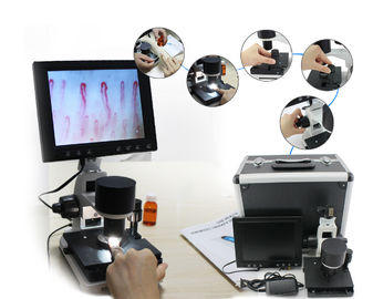 600 एलसीडी / एम 2 माइक्रोकिरकुलेशन माइक्रोस्कोप नेलफोल्ड कैपिलरी टेस्ट लैपटॉप से ​​जुड़ा हुआ है